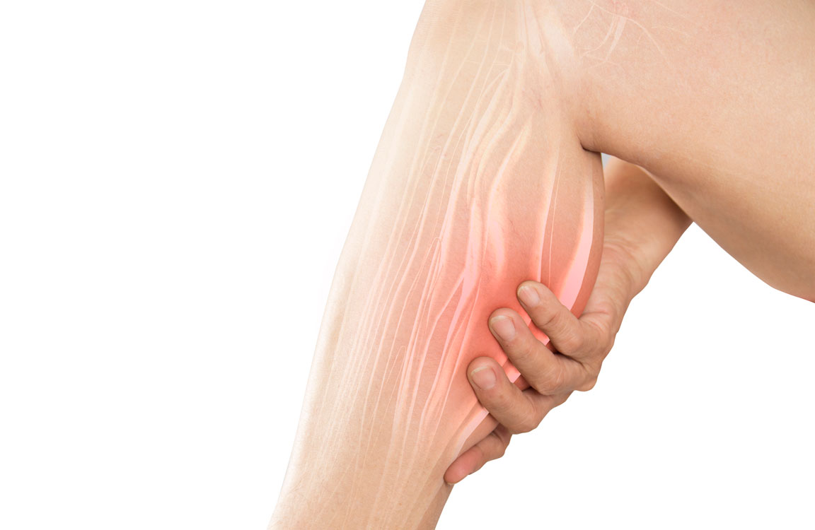Muscle Cramps: Causes and Remedies Based on Latest Science